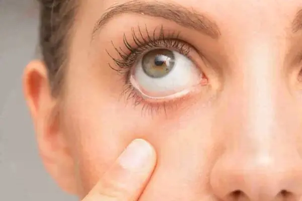 Análisis de Líquidos Oculares Eyes Center