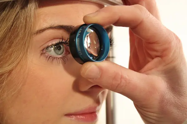Estudios de Glaucoma