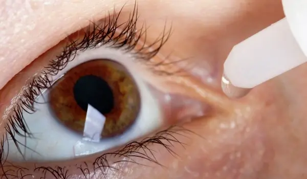 Tratamientos para aliviar los síntomas de la alergia ocular