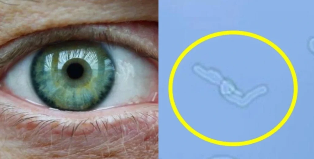 Moscas Volantes en los Ojos