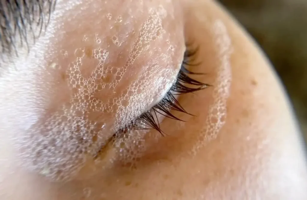higiene ocular